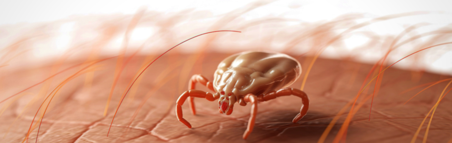 Tick on human skin