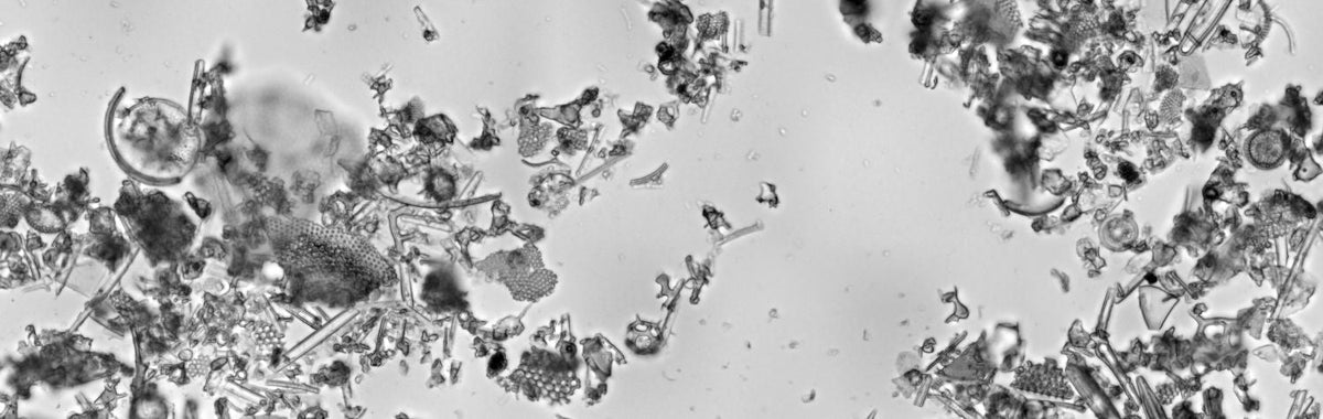 Microscope view of food grade diatomaceous earth particles