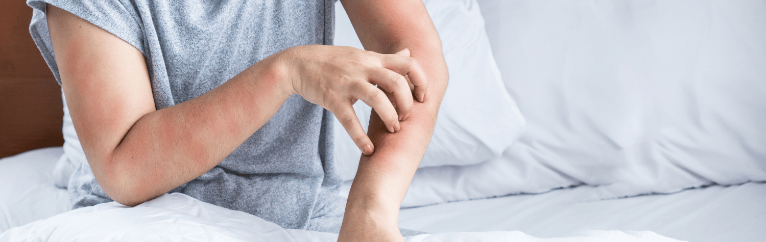 Woman scrathing her arms on the bed